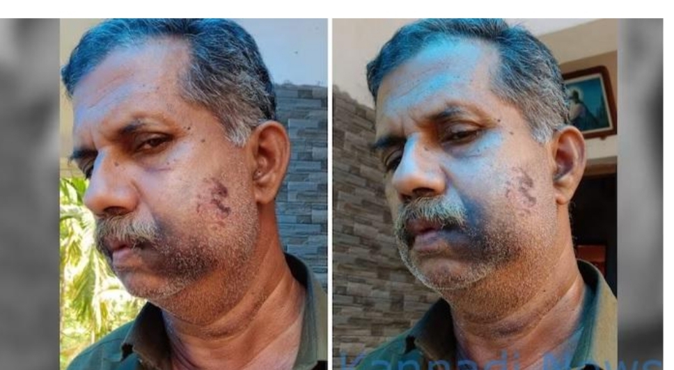 ಅವರು 4 ನೇ ತರಗತಿಯಲ್ಲಿದ್ದಾಗ ಹೊಡೆದಾಡಿಕೊಂಡಿದ್ರು… ಈಗ 50 ವರ್ಷಗಳ ನಂತರ ಭೇಟಿಯಾದಾಗ ಥಳಿಸಿ ಸೇಡು ತೀರಿಸಿಕೊಂಡ್ರು…! ಅವರು 4 ನೇ ತರಗತಿಯಲ್ಲಿದ್ದಾಗ ಹೊಡೆದಾಡಿಕೊಂಡಿದ್ರು… ಈಗ 50 ವರ್ಷಗಳ ನಂತರ ಭೇಟಿಯಾದಾಗ ಥಳಿಸಿ ಸೇಡು ತೀರಿಸಿಕೊಂಡ್ರು…!